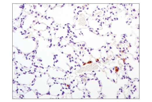 Immunohistochemistry Image 3: TIM-3 (D3M9R) XP<sup>®</sup> Rabbit mAb (BSA and Azide Free)