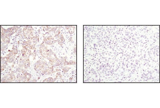 undefined Image 28: Pro-Apoptosis Bcl-2 Family Antibody Sampler Kit II