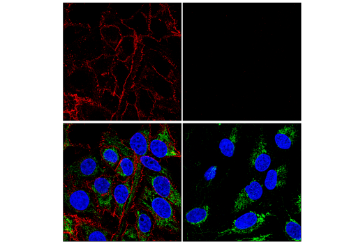 Immunofluorescence Image 1: β-Catenin (D10A8) XP<sup>®</sup> Rabbit mAb (Alexa Fluor<sup>®</sup> 594 Conjugate)