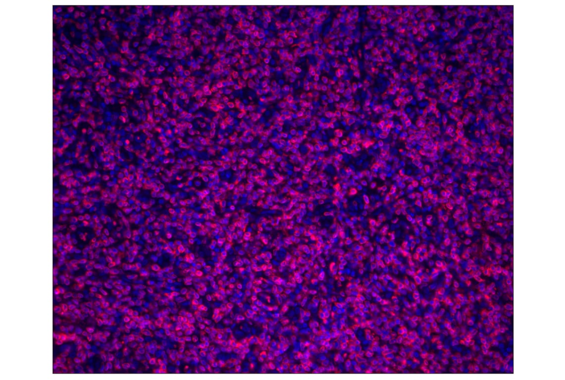 Immunohistochemistry Image 1: CD3ε (D7A6E<sup>™</sup>) XP<sup>®</sup> Rabbit mAb (Alexa Fluor<sup>®</sup> 555 Conjugate)