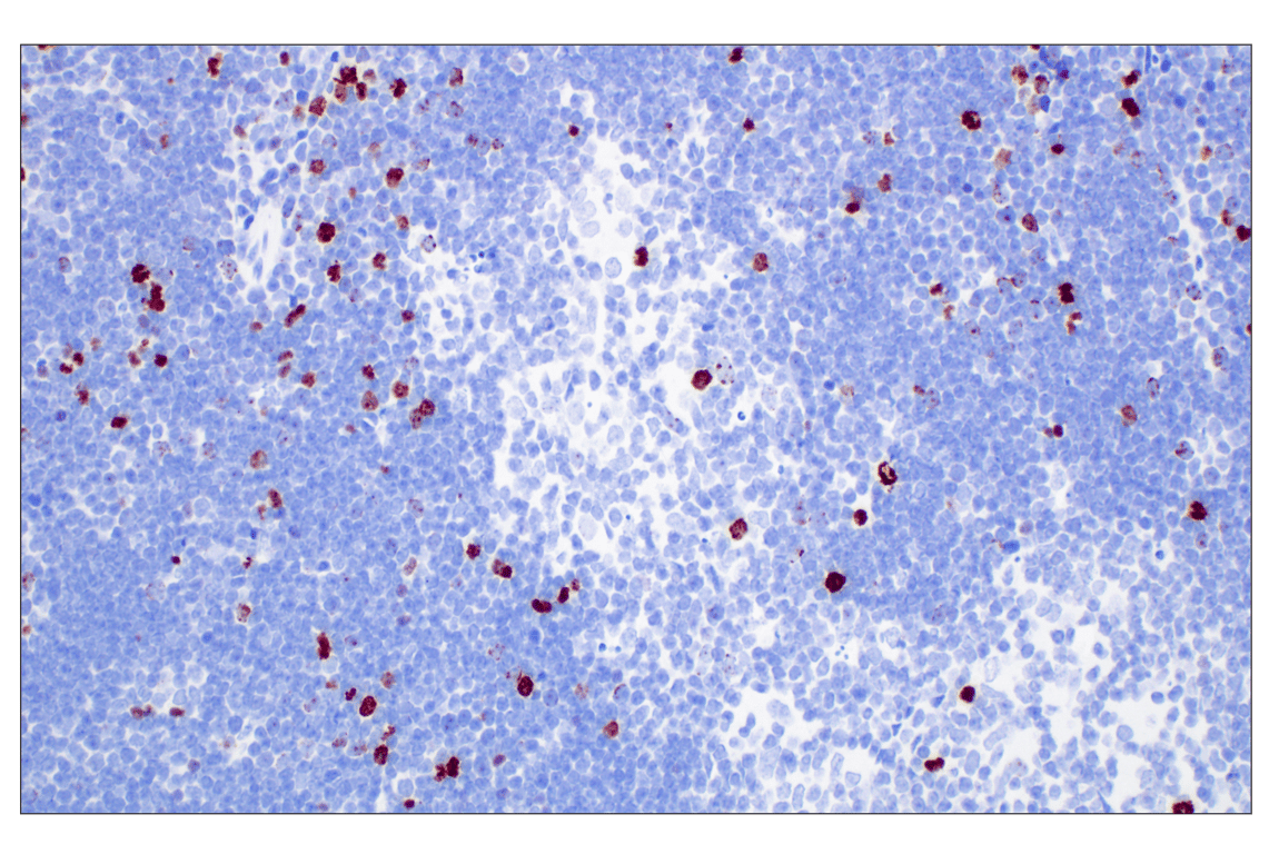 Immunohistochemistry Image 11: Phospho-Histone H3 (Ser10) (D7N8E) XP<sup>®</sup> Rabbit mAb (BSA and Azide Free)