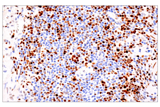 undefined Image 63: Human Exhausted CD8<sup>+</sup> T Cell IHC Antibody Sampler Kit