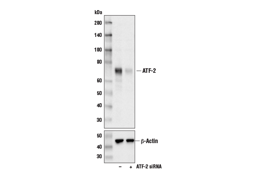 Western Blotting Image 1: ATF-2 (D4L2X) XP<sup>®</sup> Rabbit mAb (BSA and Azide Free)