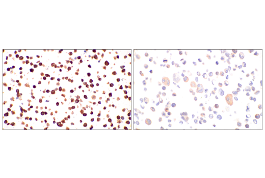 Immunohistochemistry Image 8: c-Rel (E8Z5Y) XP<sup>®</sup> Rabbit mAb (BSA and Azide Free)