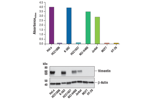 ELISA Image 2: FastScan<sup>™</sup> Total Vimentin ELISA Kit