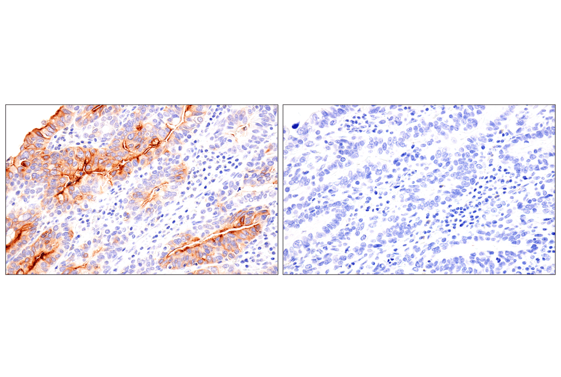 Immunohistochemistry Image 6: Folate Receptor Alpha/FOLR1 (BN3.2) Mouse mAb