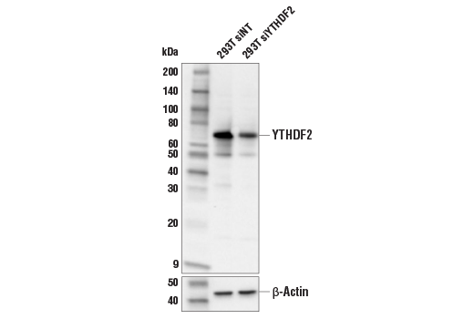 Western Blotting Image 1: YTHDF2 (E2I2H) Rabbit mAb