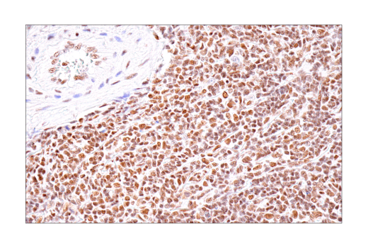 Immunohistochemistry Image 4: BRD4 (E2A7X) Rabbit mAb