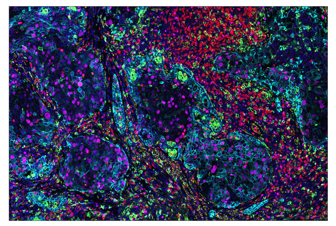 Immunohistochemistry Image 1: CD206/MRC1 (E2L9N) & CO-0035-647 SignalStar<sup>™</sup> Oligo-Antibody Pair