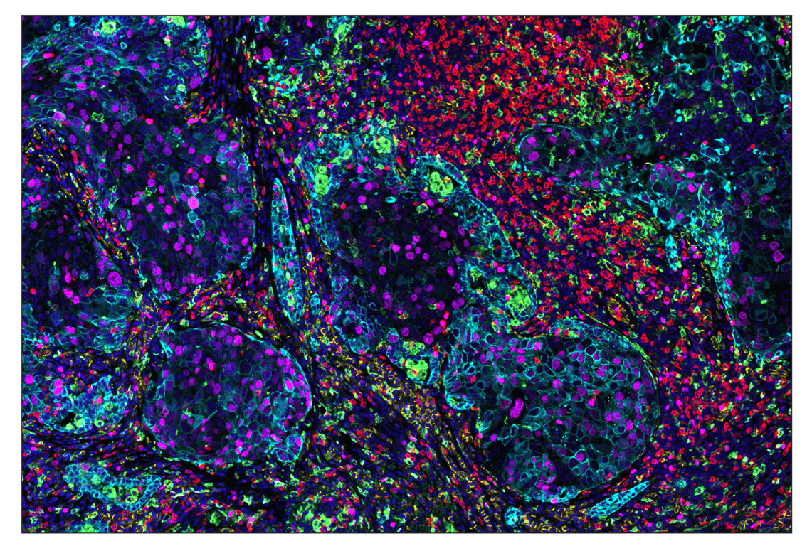 Immunohistochemistry Image 1: CD206/MRC1 (E2L9N) & CO-0035-594 SignalStar™ Oligo-Antibody Pair