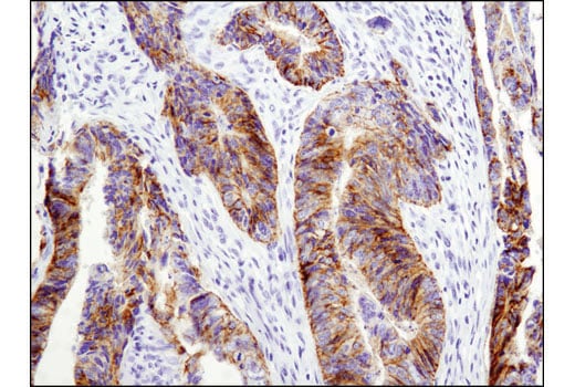 undefined Image 13: Tight Junction Antibody Sampler Kit