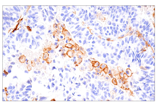 Immunohistochemistry Image 1: GM-CSF Receptor α (E8Z3S) Rabbit mAb