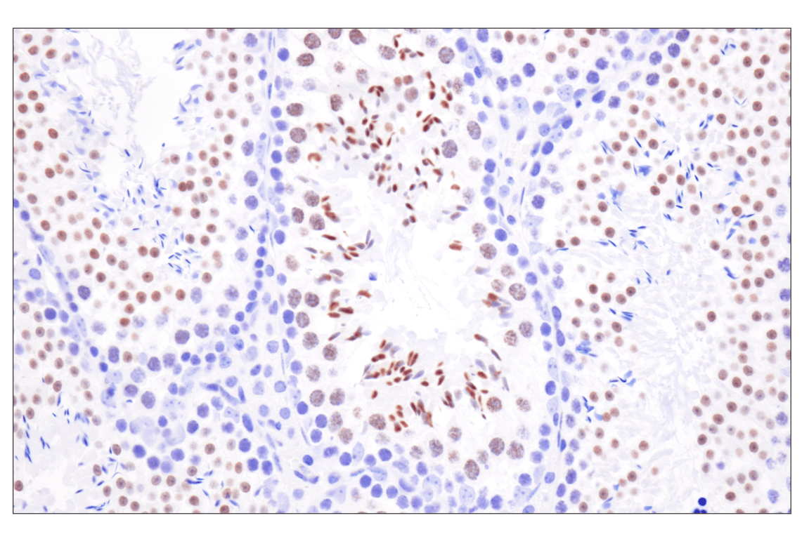 Immunohistochemistry Image 11: Acetyl-Histone H4 (Lys16) (E2B8W) Rabbit mAb