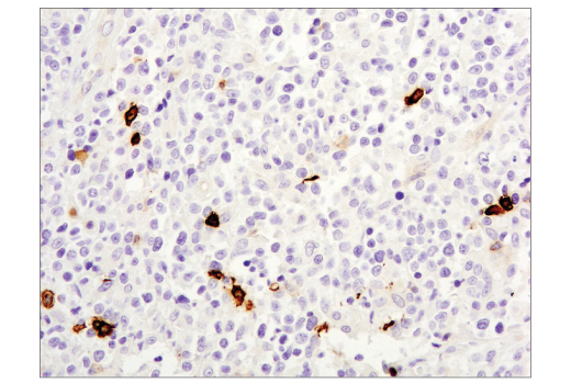 Immunohistochemistry Image 1: OX40 (E9U7O) XP<sup>®</sup> Rabbit mAb (BSA and Azide Free)