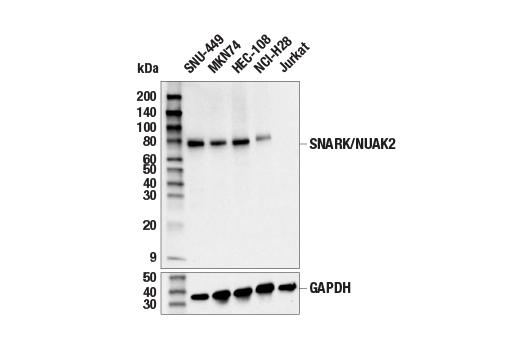 Western Blotting Image 2: SNARK/NUAK2 (E4V4Q) Rabbit mAb