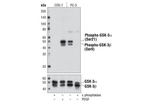 Western Blotting Image 1: Phospho-GSK-3α/β (Ser21/9) (D17D2) Rabbit mAb
