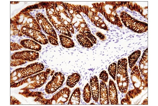 Immunohistochemistry Image 1: EpCAM (E6V8Y) XP<sup>®</sup> Rabbit mAb (BSA and Azide Free)