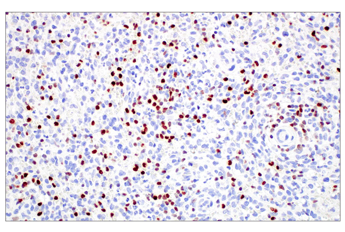 Immunohistochemistry Image 2: T-bet/TBX21 (E4I2K) Rabbit mAb