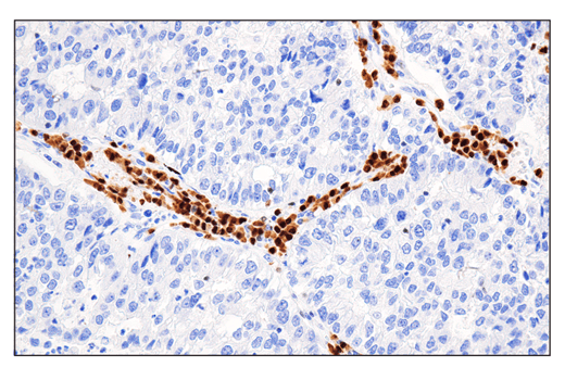 Immunohistochemistry Image 1: IRF-4 (E8H3S) XP<sup>®</sup> Rabbit mAb (BSA and Azide Free)