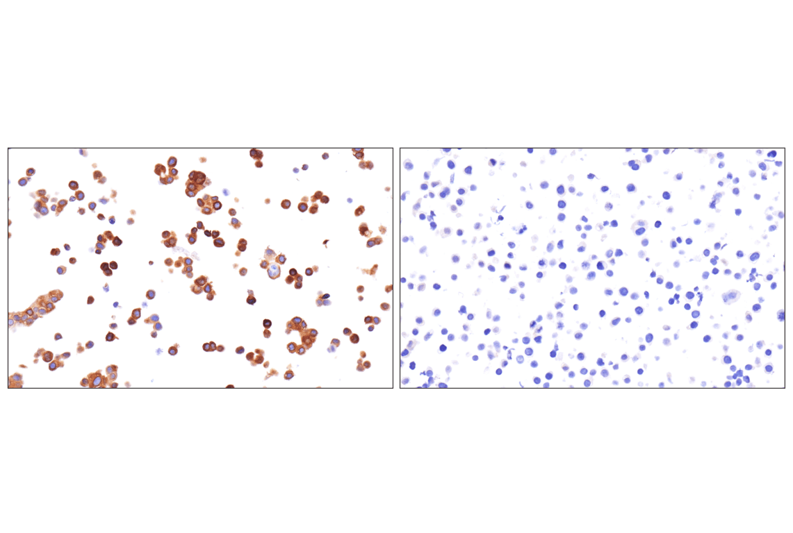 Immunohistochemistry Image 4: KK-LC-1 (F3U6C) Rabbit mAb