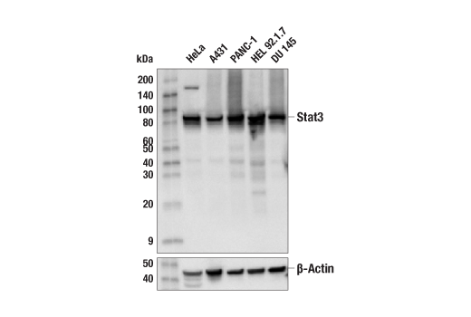 Western Blotting Image 1: Stat3 (124H6) Mouse mAb