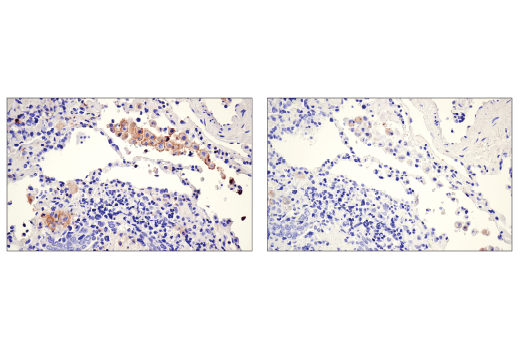 Immunohistochemistry Image 3: CD86 (E2G8P) Rabbit mAb