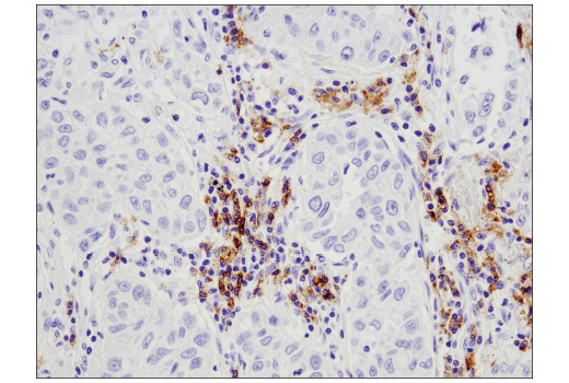 Immunohistochemistry Image 2: CD19 (Intracellular Domain) (D4V4B) XP<sup>®</sup> Rabbit mAb