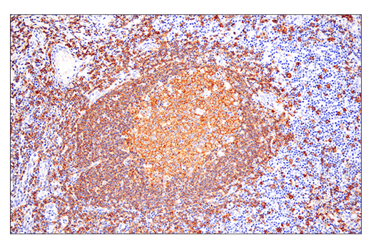 Immunohistochemistry Image 5: CD20 (E7B7T) XP<sup>®</sup> Rabbit mAb