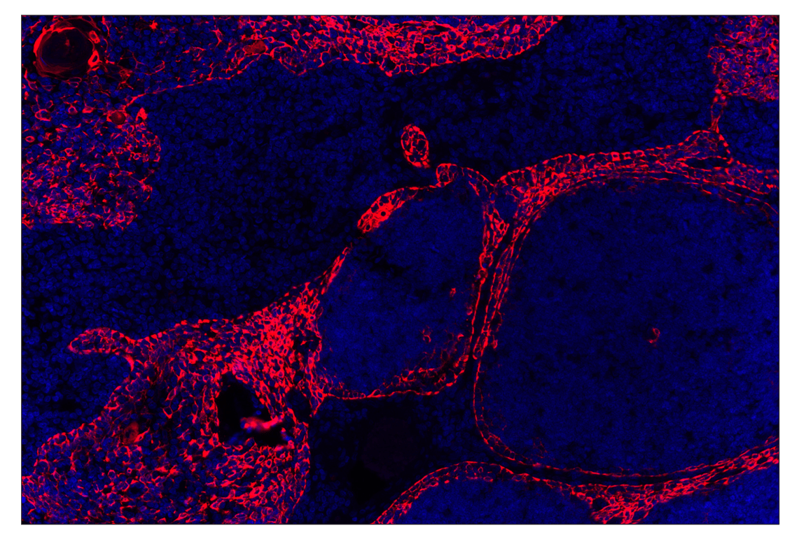 Immunohistochemistry Image 2: Keratin 17/19 (D4G2) XP<sup>®</sup> Rabbit mAb (Alexa Fluor<sup>®</sup> 555 Conjugate)