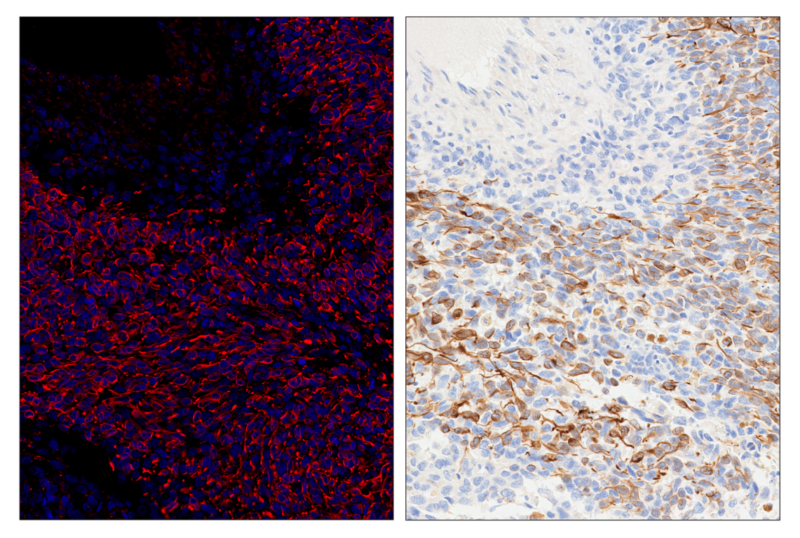 Immunohistochemistry Image 6: OX40L (D6K7R) & CO-0087-750 SignalStar<sup>™</sup> Oligo-Antibody Pair