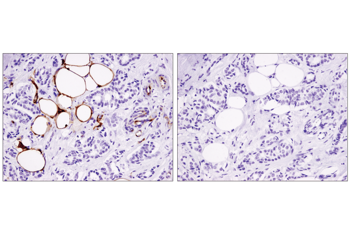 Immunohistochemistry Image 2: CD36 (D8L9T) Rabbit mAb (BSA and Azide Free)