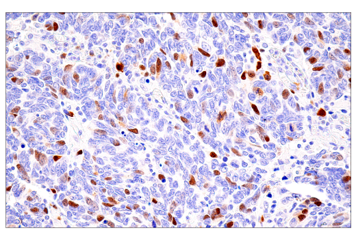 Immunohistochemistry Image 6: Cyclin A2 (E6D1J) XP<sup>®</sup> Rabbit mAb