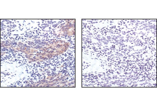 undefined Image 4: PhosphoPlus<sup>®</sup> Bad (Ser112) Antibody Duet