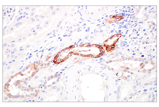 Immunohistochemistry Image 6: Integrin β6 (E4M9P) XP<sup>®</sup> Rabbit mAb