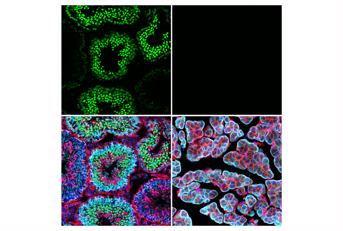 Immunofluorescence Image 1: ATAD2 (E8Y7F) Rabbit mAb