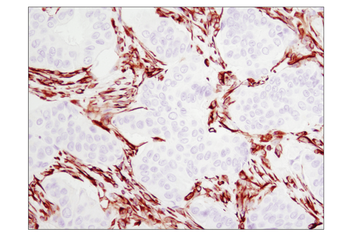 undefined Image 33: Cell Fractionation Antibody Sampler Kit