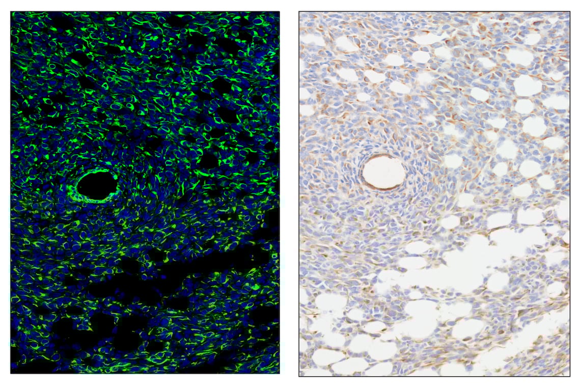 Immunohistochemistry Image 6: Pan-Keratin (Type I) (E6S1S) & CO-0072-594 SignalStar<sup>™</sup> Oligo-Antibody Pair
