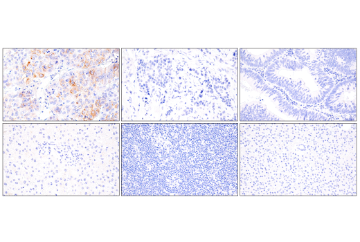 Immunohistochemistry Image 1: AFP (C3) Mouse mAb