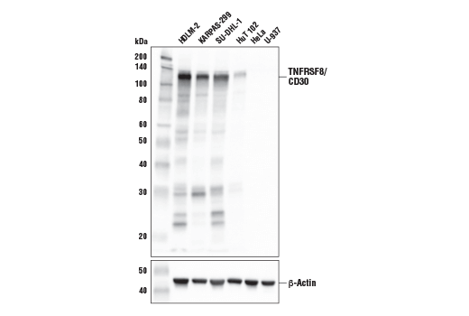 Western Blotting Image 1: TNFRSF8/CD30 (E4L4I) XP® Rabbit mAb