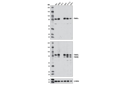 Western Blotting Image 1: Stat3α (D1A5) XP<sup>®</sup> Rabbit mAb
