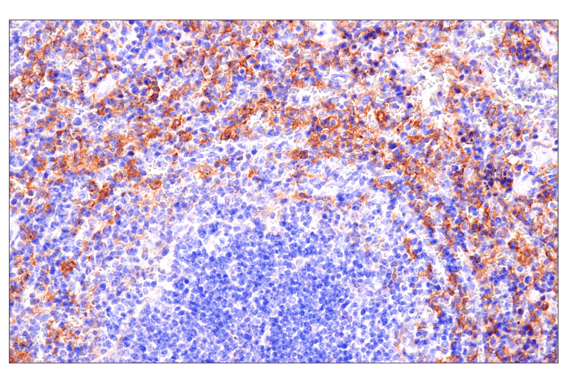 Immunohistochemistry Image 5: Axl (E3Z2H) Rabbit mAb