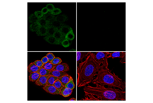 Immunofluorescence Image 1: RIP3 (E7A7F) XP<sup>®</sup> Rabbit mAb