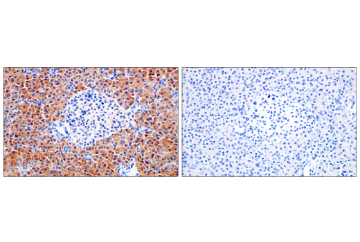 Immunohistochemistry Image 8: Asparagine Synthetase (E6C2C) XP<sup>®</sup> Rabbit mAb (BSA and Azide Free)