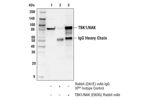 undefined Image 26: Xenophagy Antibody Sampler Kit