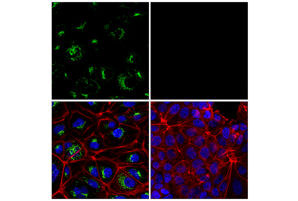 Immunofluorescence Image 1: AFP (C3) Mouse mAb