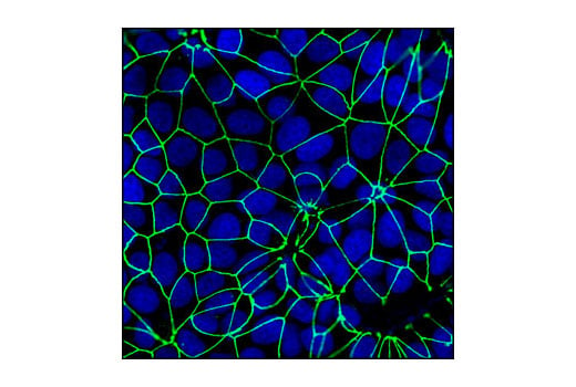 Immunofluorescence Image 1: ZO-3 (D57G7) XP<sup>®</sup> Rabbit mAb