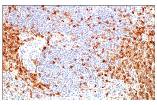 Immunohistochemistry Image 6: CD5 (E8X3S) XP<sup>®</sup> Rabbit mAb