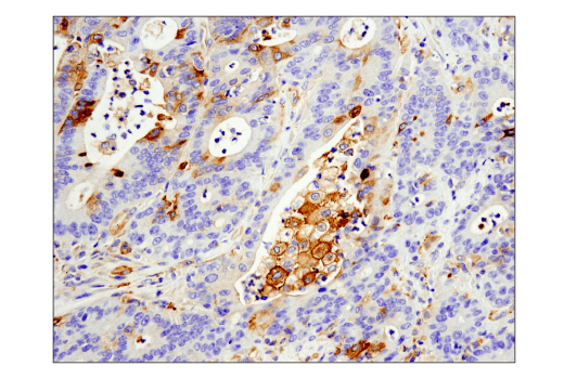 Immunohistochemistry Image 1: IFIT1 (D2X9Z) Rabbit mAb