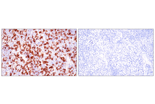 undefined Image 78: Human Exhausted CD8<sup>+</sup> T Cell IHC Antibody Sampler Kit