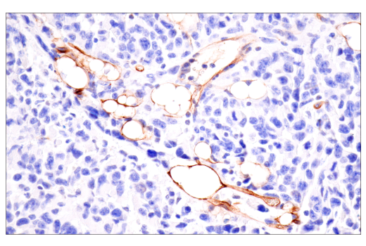 Immunohistochemistry Image 7: CD36 (E8B7S) Rabbit mAb